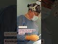 korekcja nosa nosejob timeless dr janusz jaworowski