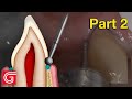 HOW TO Prepare Anterior Teeth for Zirconia Crowns