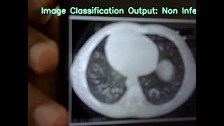 Machine learning Tumor Detection Pictoblox Python