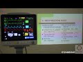 vital sign assessment with patient monitor មេរៀនការតាមដានសញ្ញាជីវិតបកស្រាយផ្ទាល់ជាមួយ​ឧបករណ៍តាមដាន