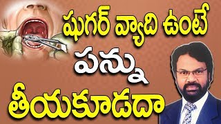 షుగర్ వ్యాధి ఉంటే పన్ను తీయకూడదా | Teeth Problems InTelugu | Teeth Removal | Dr. Rao's Dental | Tips