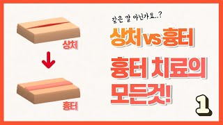 상처 vs 흉터! 흉터치료의 모든것! [닥터유티비 7화 흉터의 모든것! 1편]