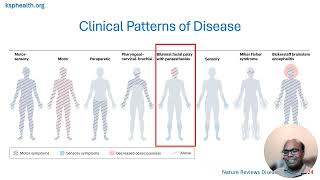 How to diagnose and treat Guillain-Barre Syndrome?