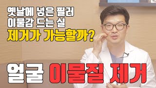 옛날에 넣은 실이나 필러, 제거가 가능할까요? | 얼굴 이물질 제거 |