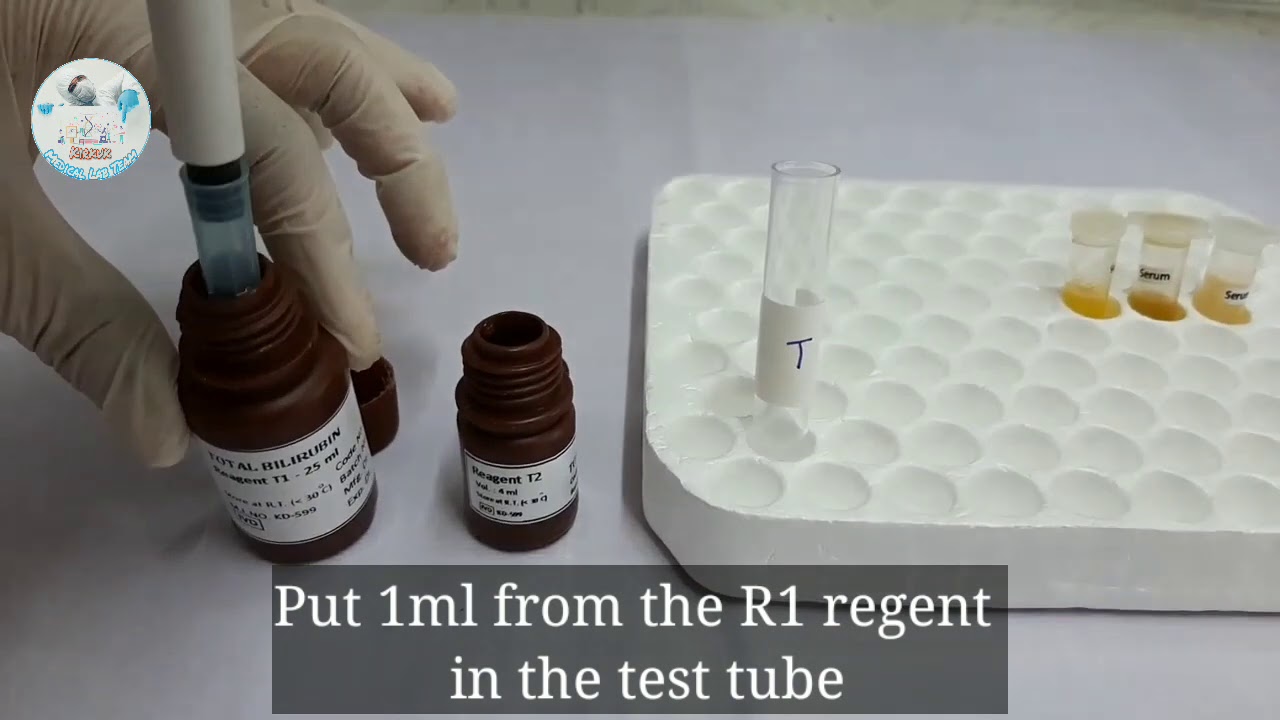 Blood Urea Nitrogen Test Procedure BUN - YouTube