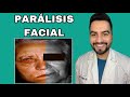 TENGO PARALISIS FACIAL / PARALISIS DE BELL / PARALISIS FACIAL PERIFERICA | DR. DAVID CAMPOS