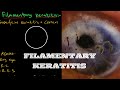 Filamentary Keratitis | Ophthalmology