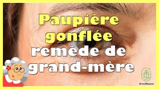 Paupière gonflée remède grand-mère