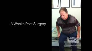 SuperPATH Hip Replacement | 3 Weeks Post Surgery