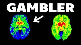 How Gambling Addiction Changes Your Brain