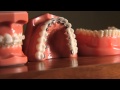 Treatment Options Available in Orthodontics