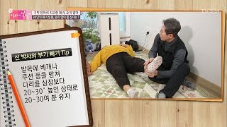 전문의가 말해주는 다리 부기 빼기 TIP [엄마의 봄날] 82회 20170326