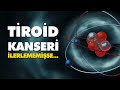 her tiroid kanserine atom tedavisi gerekir mi