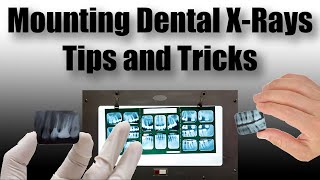 Dental Things - Mounting X Rays Films