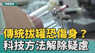 義守大學媒體識讀 | 傳統拔罐可能傷身？ 科技方法解除疑慮