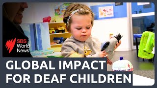 Cochlear implant therapy goes global | New pilot helps deaf children thrive
