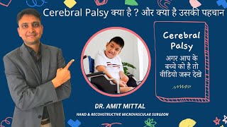 Cerebral Palsy (सेरेब्रल पाल्सी ) क्या है ? Symptoms \u0026 Treatment of Cerebral Palsy in Hindi