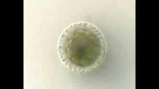 Desmids: Penium spirostriolatum var. amplificatum, cell top., focus-through video by Chris Carter