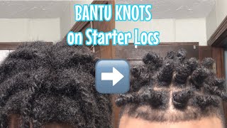 How to do Bantu Knots on Starter Locs (For all hair types)