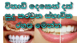 අවපැහැ දත්  දෙපෙළ විනාඩි දෙකෙන්  සුදු කරගන්න