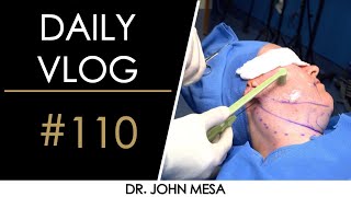 FaceTite! | Daily Vlog #110 By Dr. Mesa