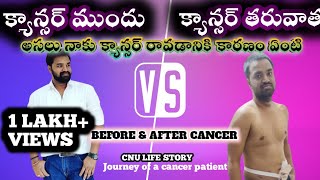 What happened to me before I got cancer? Did that happen to me cause cancer..before & after cancer