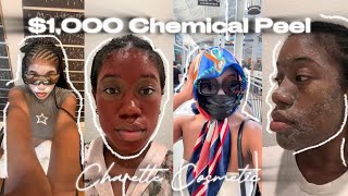 25 Days of Charette Cosmetics' $1,000 Chemical Peel Level 2: My Full Experience \u0026 Review in 25 mins