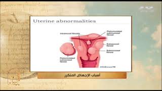 الحكيم في بيتك | 40% من مسبباته غير معروفة.. أسباب الإجهاض المتكرر