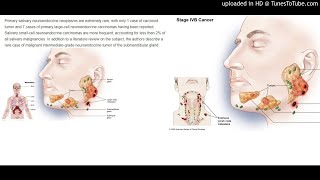 Salivary Neuroendocrine Carcinoma