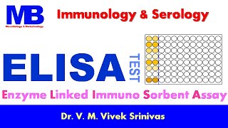 ELISA | Immunology & Serology | Vivek Srinivas | #ELISA #Serology #Diagnostics