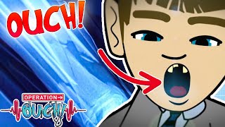 @OperationOuch - Broken Bones and Busted Teeth! | Science for Kids