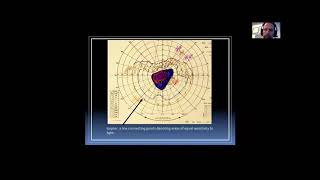 Visual Field Interpretation