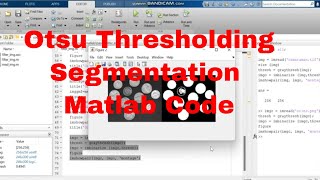 Image Segmentation Matlab / Segmentation with Otsu thresholding algorithm