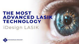 Dr. Robert Warren Talks About iDesign LASIK