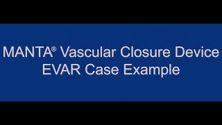 MANTA® Vascular Closure Device EVAR Live Case