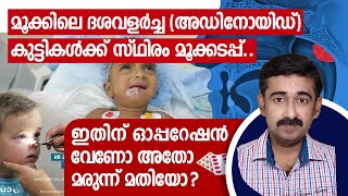 മൂക്കിലെ ദശവളർച്ച (അഡിനോയിഡ്) കുട്ടികൾക്ക് സ്ഥിരം മൂക്കടപ്പ്ഇതിന്  ഓപ്പറേഷൻ വേണോ അതോമരുന്ന് മതിയോ ?