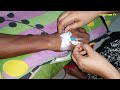 cannula saline খোলার নিয়ম। cannula removing video.