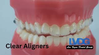 Invisalign Las Vegas Dental Group 702-870-5165 | Invisalign Providers LVDG #invisalign #aligners