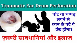 Traumatic Ear drum perforation. क्या सावधानी रखें। चोट लगने से कान के परदे pe छेद।