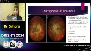 KSOS 2024   IC99   Ocular tuberculosis  A closer look into an increasing reality