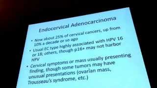 Cervical Adenocarcinoma- Phat Trien GPB VN group