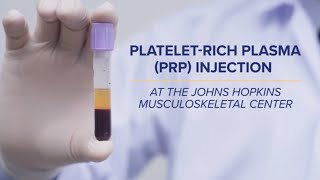 Platelet-Rich Plasma (PRP) Injections | Q&A