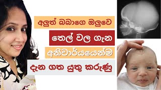 අලුත් බබාගේ තෙල් වල ගැන ඔබ දැනගතයුතු කරුණු | Anterior Fontanelle | Thel wala | Krish and Hansi vlogs