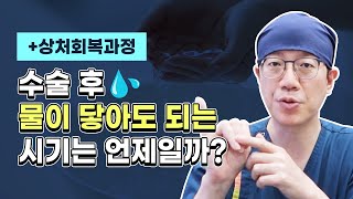 수술 후 물이 닿아도 되는 시기는 언제🤔? (with.상처회복과정)