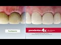 Parodontax toothpaste for healthy gums and strong teeth (Marathi)