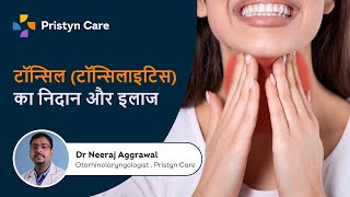 टॉन्सिल (टॉन्सिलाइटिस) का निदान और इलाज  | Tonsillitis in Hindi