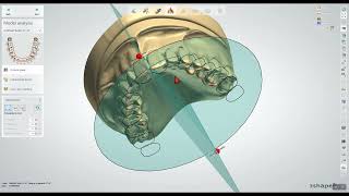 Creating Prostheses with Novaloc \u0026 MedentiLOC Library in 3Shape Dental System (2024)