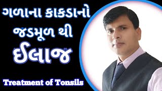 Ayurvedik Treatment for Tonsil | કાકડા નો દેશી ઉપાય | કાકડા નો ઈલાજ | #tonsils #કાકડો