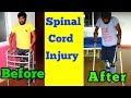 spinal cord injury paraplegic before and after improvement