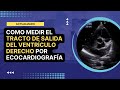 🏅[Cómo medir] el TRACTO DE SALIDA DEL VENTRÍCULO DERECHO (TSVD) por ecocardiografía: Actualizado